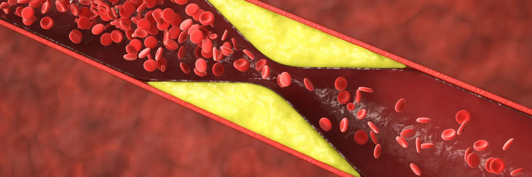 Coronary Artery Disease Specialist