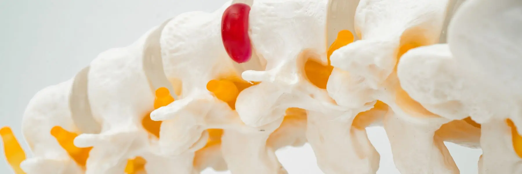 Degenerative Disc Disease