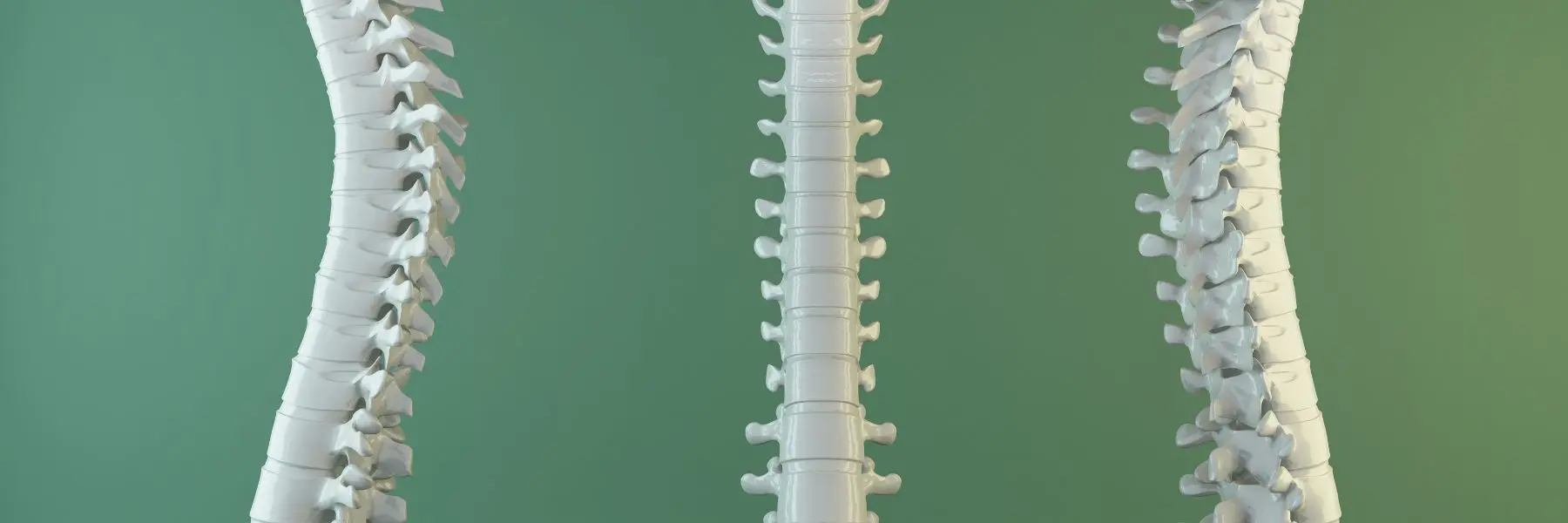 Pediatric Spine Specialists