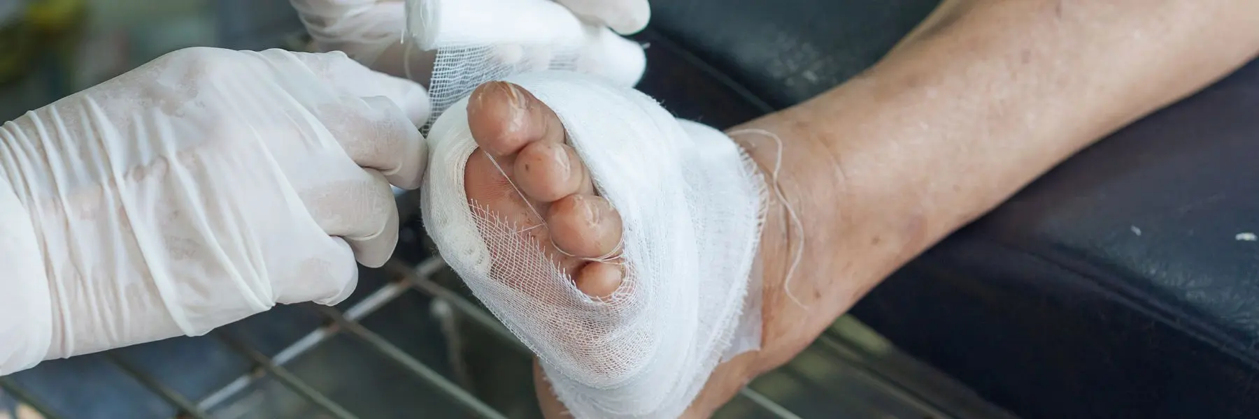 diabetic wound care services